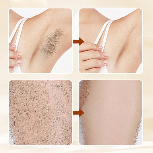 🔥Limited Time Promotion 50% OFF✨Versatile Aromatic Hair Removal Cream