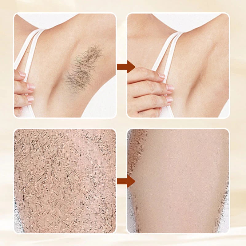 🔥Limited Time Promotion 50% OFF✨Versatile Aromatic  Hair Removal Cream